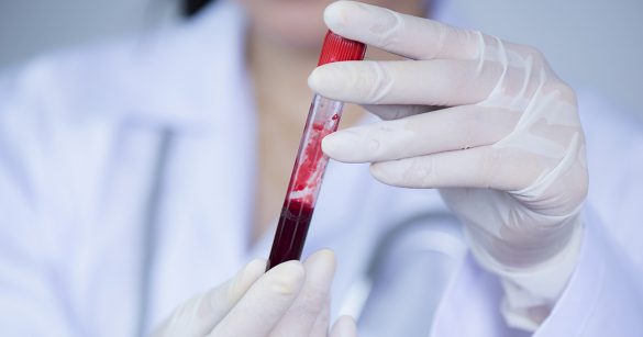 Учёные научились диагностировать болезни по излучению в сыворотки крови
